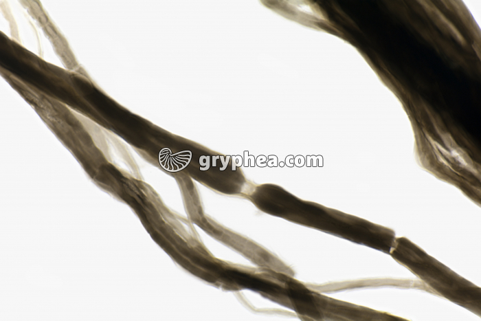 Noeuds de Ranvier Nerf AO dissociation x100 - gryphea.com